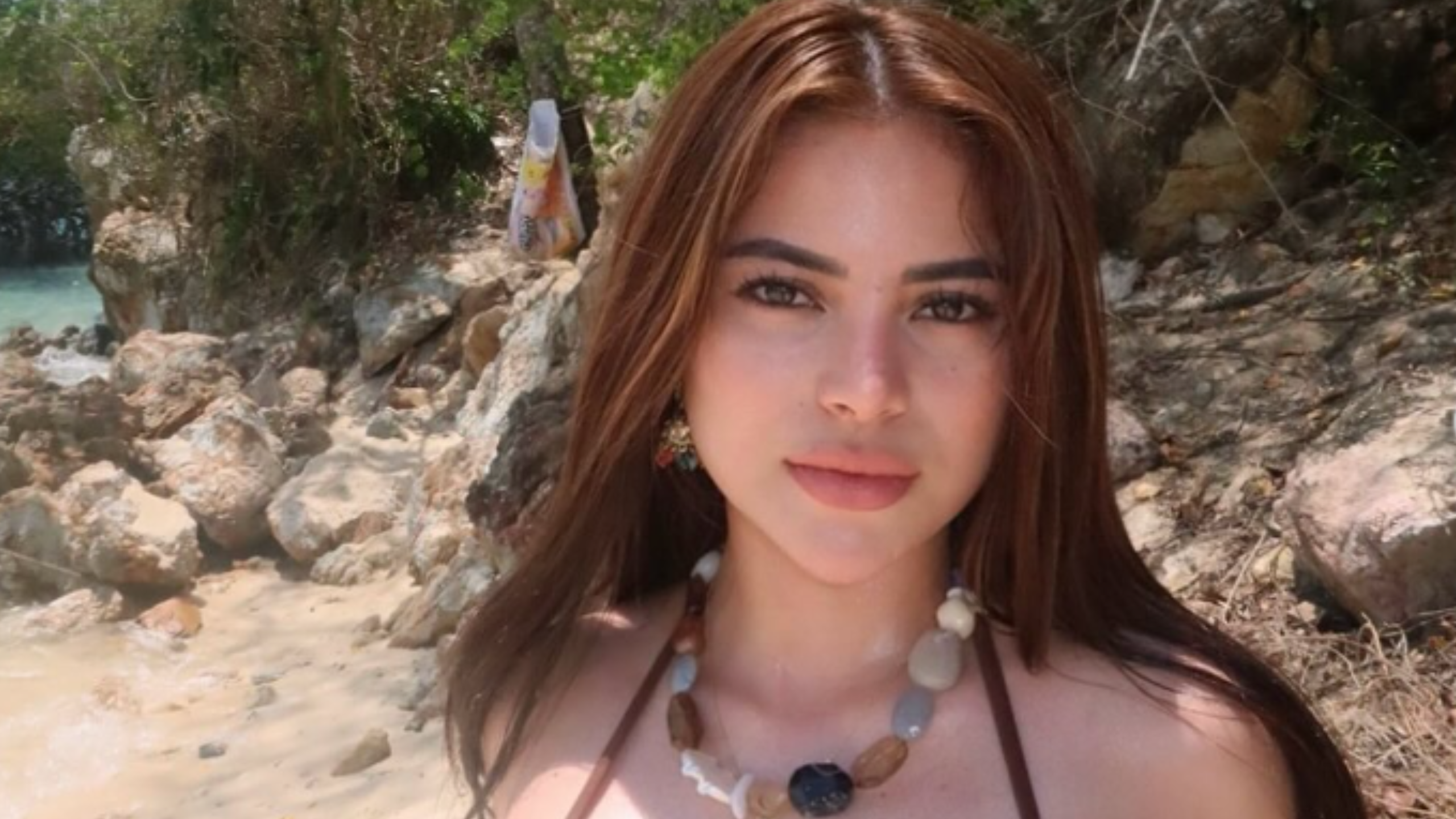 Did Adult Star Gina Lima Commit Suicide? Bruises From Alleged Beating May Have Been Caused By A Medical Condition